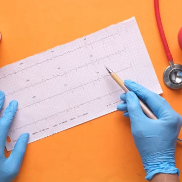 EKG